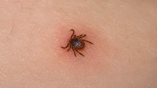 8 запахов, которых клещи боятся как огня — знакомый егерь раскрыл секреты защиты от опасных кровососов 